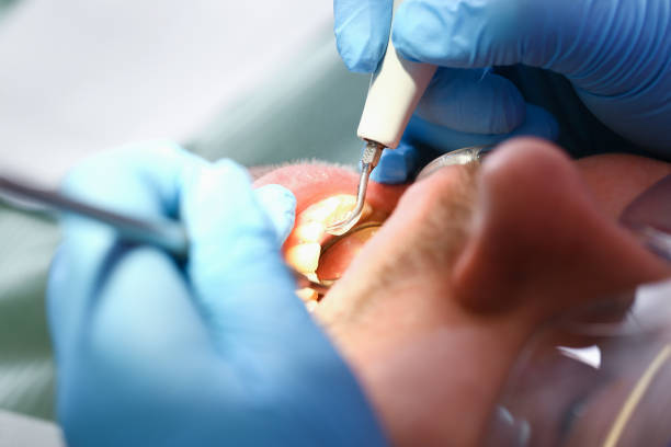 Best Emergency Treatment for Dental Infections or Abscesses in Ben Bolt, TX