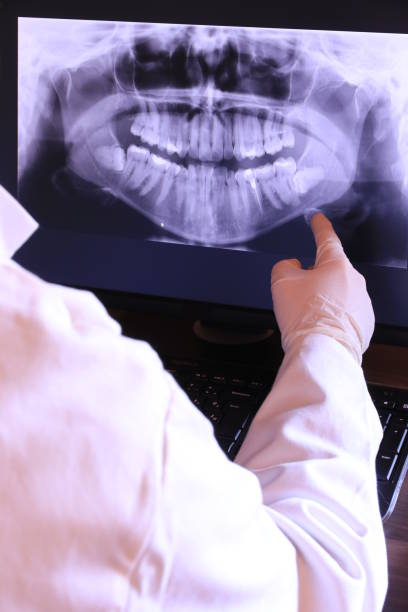 Best Emergency Tooth Extraction in Ben Bolt, TX